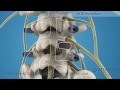 Transforaminal Lumbar Interbody Fusion(TLIF) Procedure