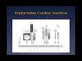 UI Heart and Vascular Center EP CME Series: Ambulatory ECG Monitoring with Dr. Johnston