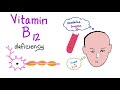 Vitamin B12 (Cobalamin) 🐚 🥩 🐠 | Most Comprehensive Explanation