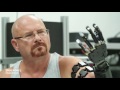 The Robot-Arm Prosthetic Controlled by Thought