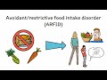 Eating Disorders (Anorexia, Bulimia, and Binge Eating) Mnemonics (Memorable Psychiatry Lecture)