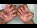 How To Remove Acrylic Nails | Soak Off Nails | Acrylic Nails Removal