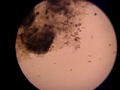 Paramecium under microscope I.