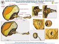 Detailed micro-CT anatomical study of the Spermatheca of the Asian Citrus Psyllid (Diaphorina citri)