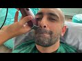 MAJOR Transformation | How to Fade Balding Hair & Apply Hair Fibers