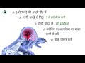 सर्दियों में ब्रेन स्ट्रोक ले सकता है जान, बचना है तो अपनाएं ये अचूक उपाय