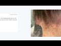 OLAPLEX RUINING PEOPLE'S HAIR AND CAUSING MAJOR HAIR LOSS and hair breakage/Natural Hair